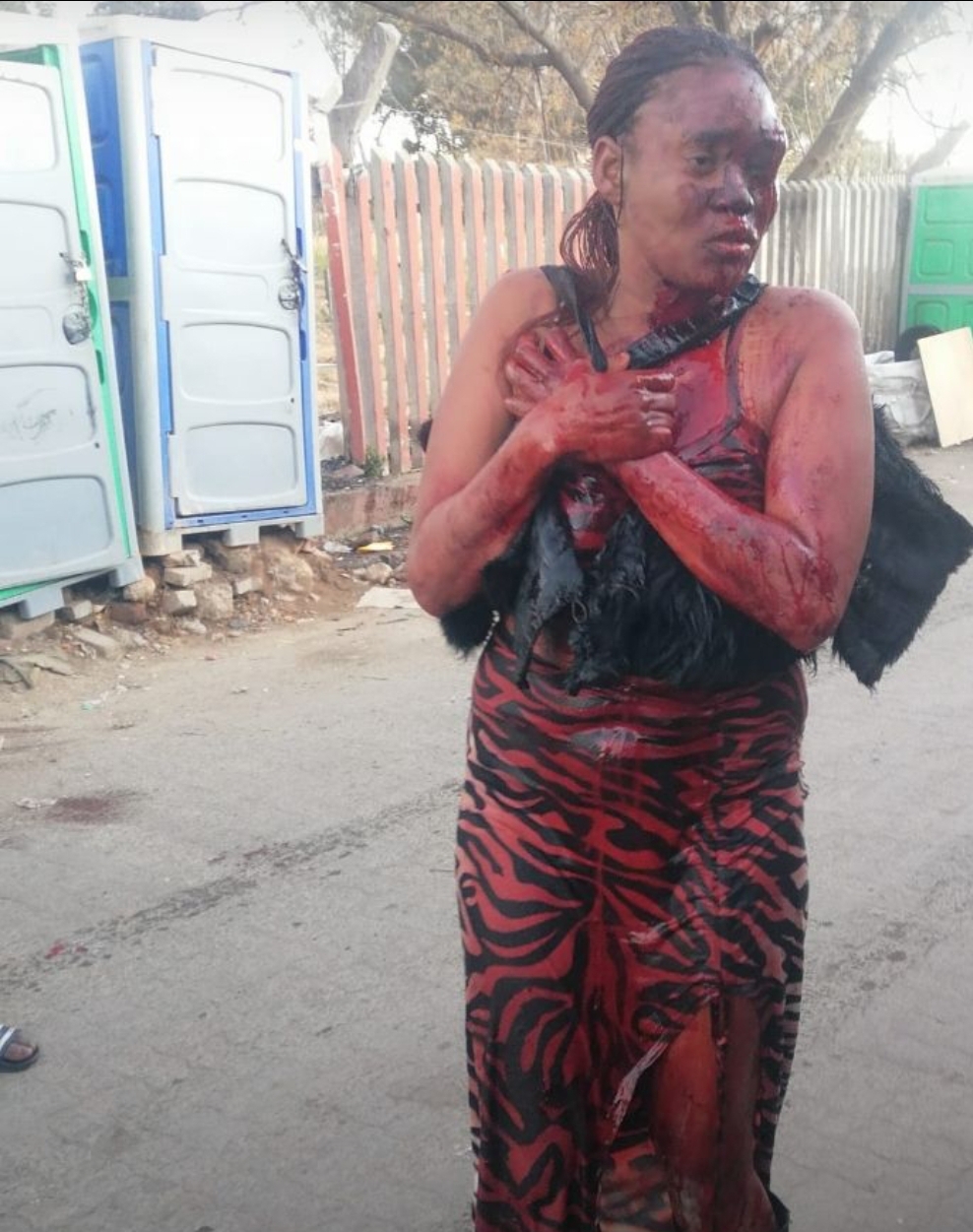 This woman was severely assaulted and was found by Setjwetla patrollers with blood all over her body in the graveyard